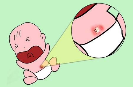 新生儿脐带能抹药吗,新生儿脐带消毒的方法是什么