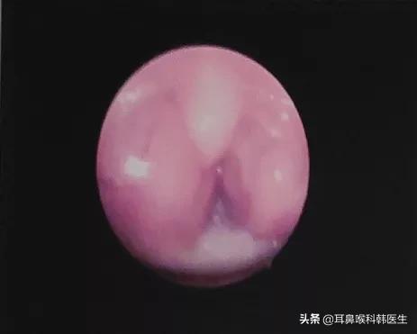 为啥来院就做内镜检查？医生怕是在骗我钱吧