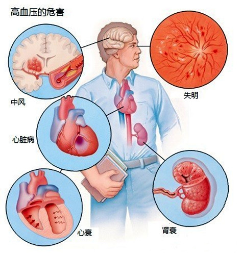 高血压吃着药血压反复升高咋回事,降压药对血管硬化有帮助吗