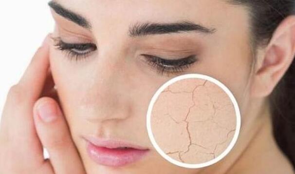 面部缺水贴完面膜需要做什么,面部缺水用面膜会痒么