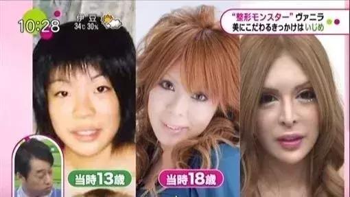日本妹子花1286万元整容成芭比娃娃？！见识到了“可怕”……