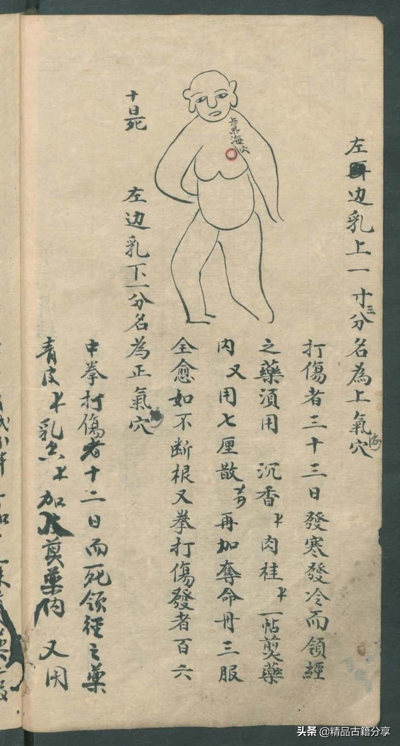 中医类抄本跌打损伤方面的医书欢迎阅读