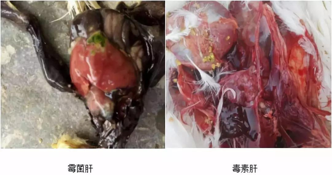 “五颜六色”的粪便背后隐藏着什么？又和肝脏疾病有怎样的联系呢