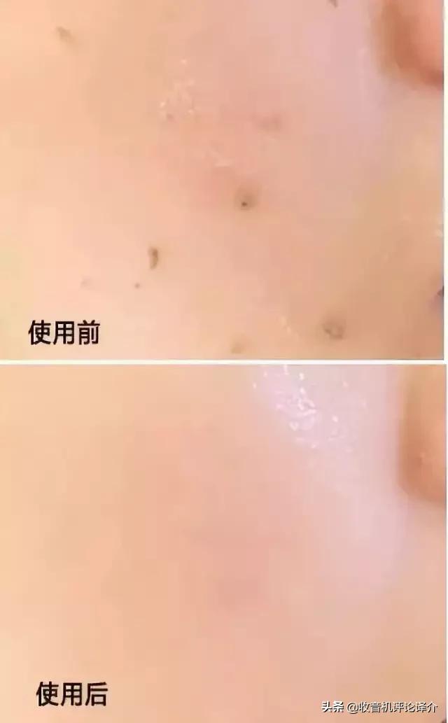 泰国发明的去角质慕斯火了！搓一搓脏东西就出来，脸上干净又白嫩