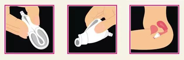 科普月经杯,月经杯真的实用