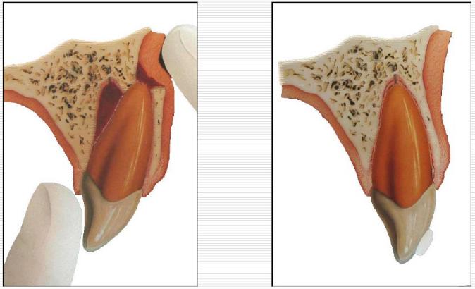 3岁小孩牙齿要怎么保护,儿童牙齿外伤需要检查什么