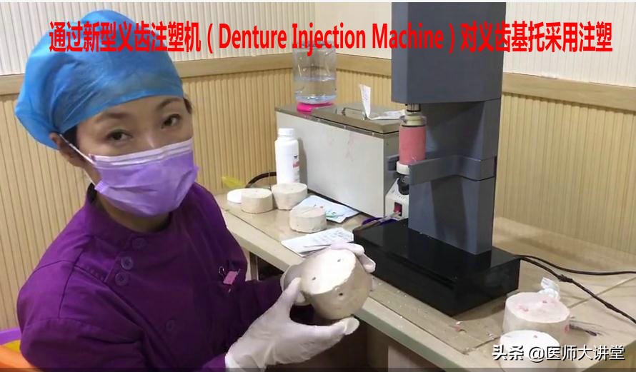 活动假牙排牙制作,下牙义齿制作