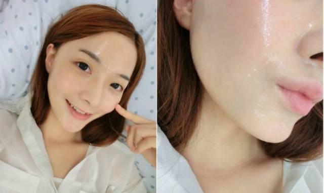 脸上细纹干纹皱纹怎么遮盖,细纹和皱纹怎么治疗