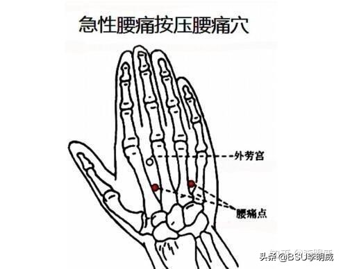 腰扭伤了，应该怎么办？（案例分析）