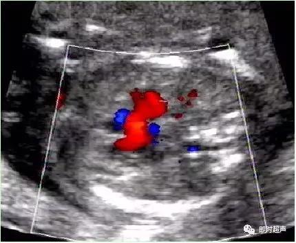 产科常规彩色超声报告单介绍,常见妇科疾病超声报告