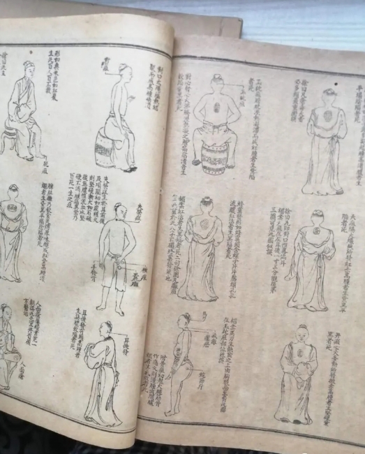 《外科正宗》：大明好先生带病编撰的一代外科医典