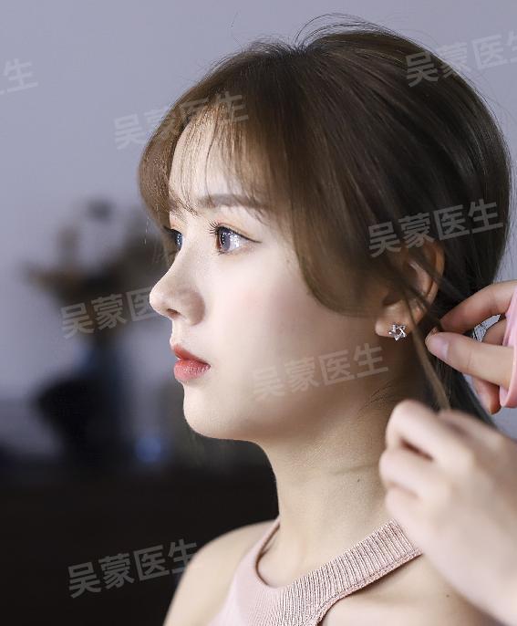 鞠婧祎鼻子整过吗,鞠婧祎的鼻子整过吗