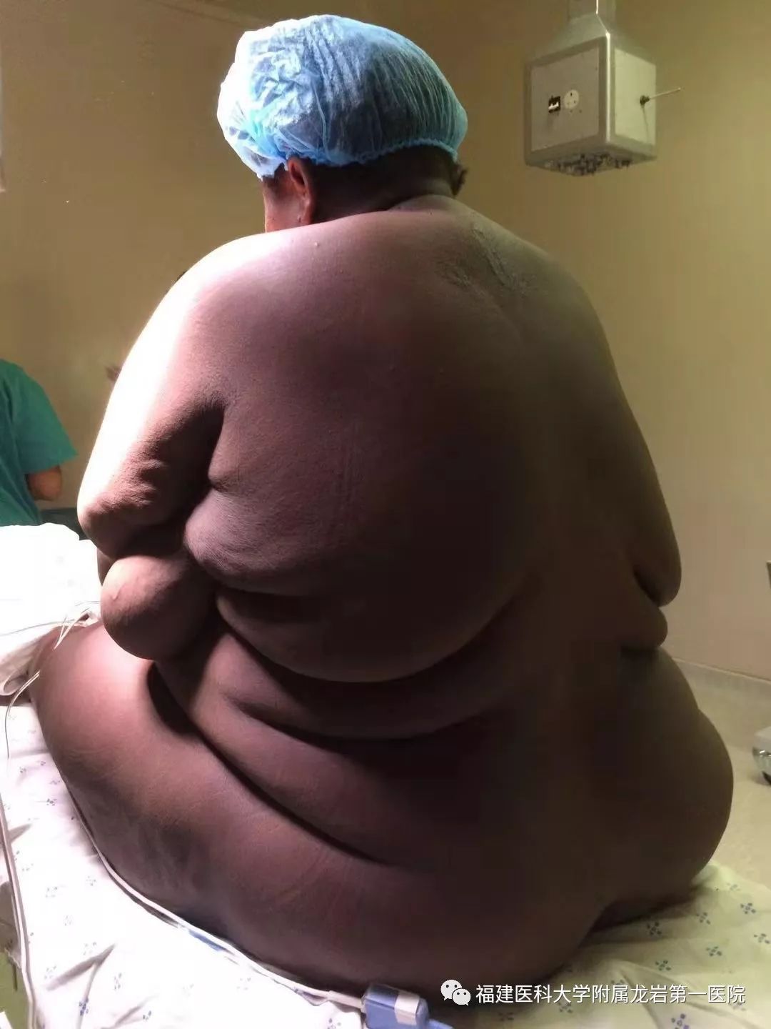 龙岩第一医院：医道*界无**，远赴非洲，让胸前的五星红旗更加闪耀