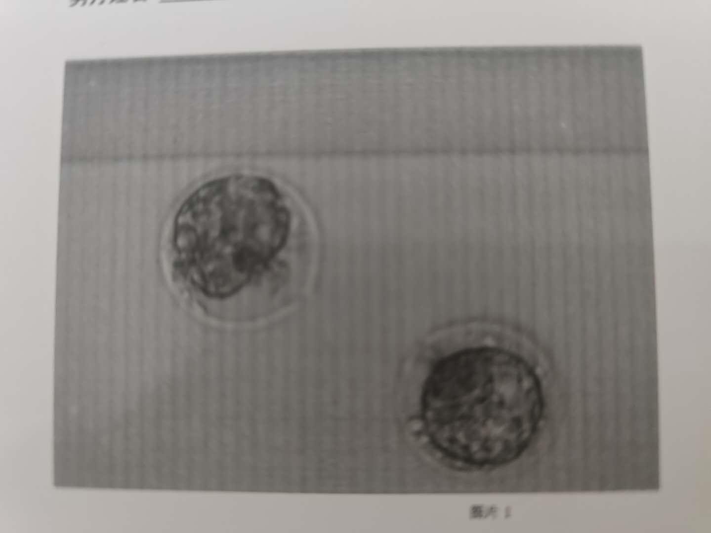 孕妇套话医生问男女，被识破臊一脸，这7项看男女的说法有效吗？