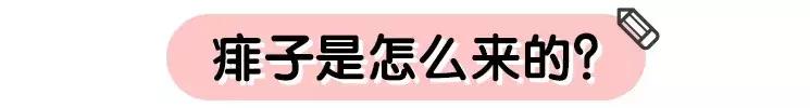 宝宝容易长痱子用什么爽身粉,宝宝长痱子怎么用炉甘石洗剂