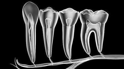 牙齿矫正有后遗症这是真的吗,牙齿矫正的后遗症跟危害