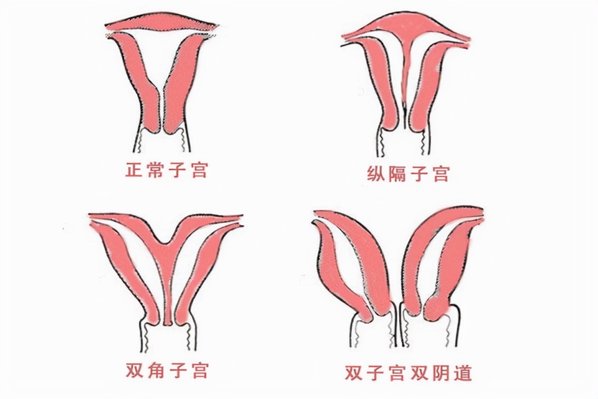 月经滴滴答总是不干净吃什么药,月经不顺畅稀稀拉拉十几天不干净