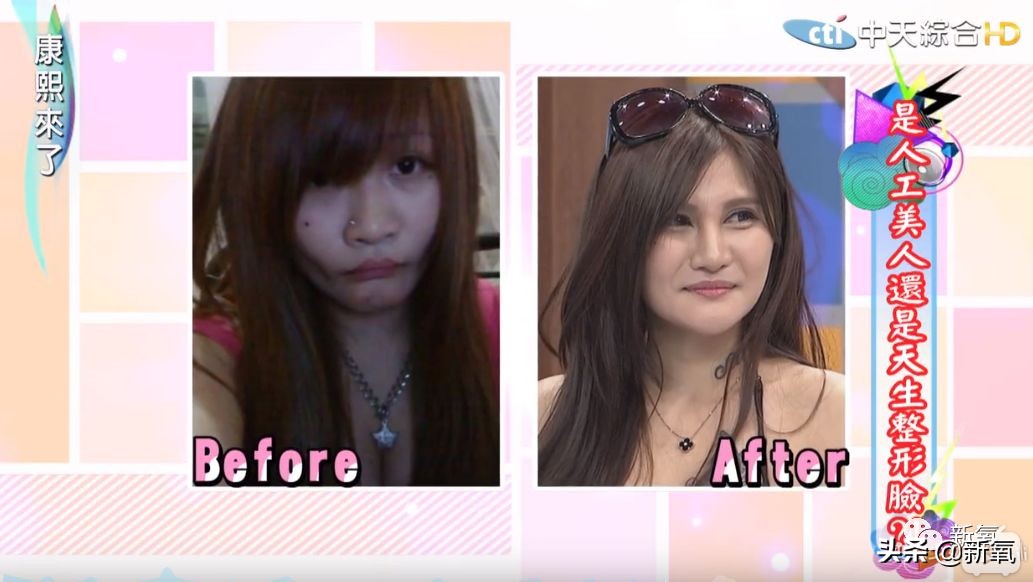 花90万从头整到脚，还可以这么自然？旁边纯天然小姐姐都看懵了