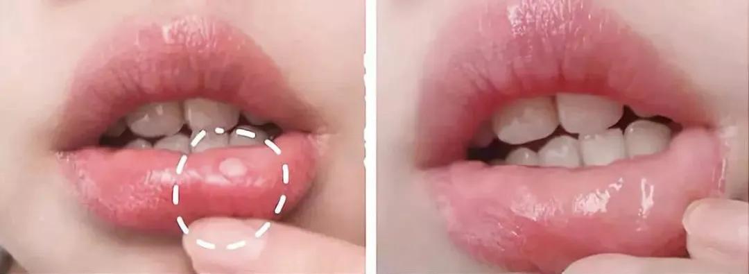 口腔专用香水,能持久留香的口腔香水