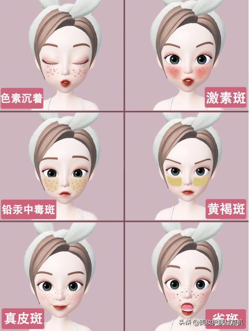 斑的种类及护理建议,斑点总去不掉先看看你是哪种斑