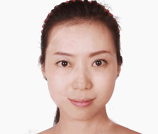 夏天晒黑的皮肤冬天不容易白回来,夏天晒黑了怎么白回来