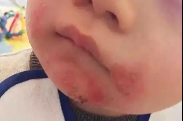 捏宝宝脸流口水,捏宝宝脸颊导致流口水吗