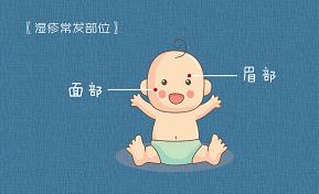 破皮结痂，又到湿疹高发季！这样护理更有效果