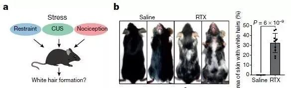 一夜白头是有心事吗,一夜白头是真实案例吗