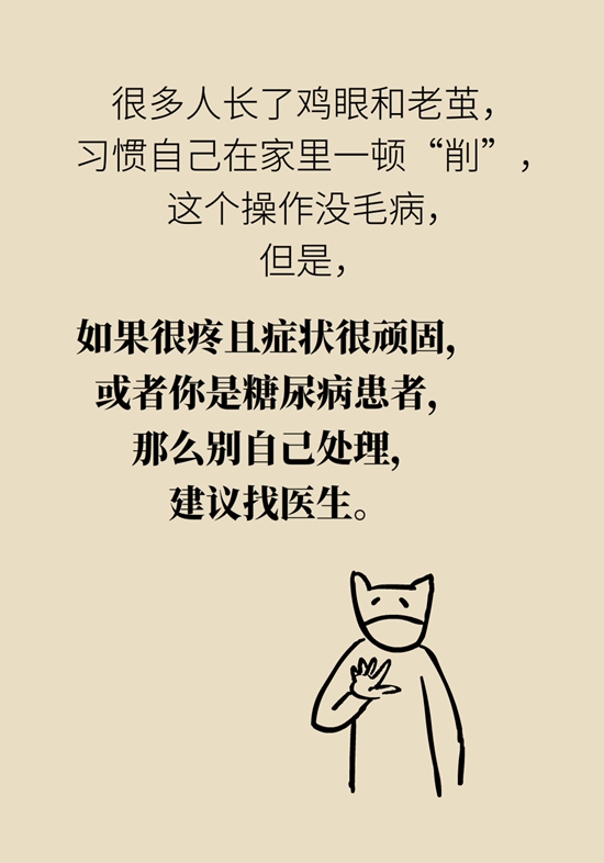 长了鸡眼该怎么办四大妙招教给你,长了鸡眼怎么治疗好得快