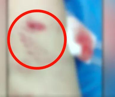 紧急提醒一周接诊超500例,已进入秋冬季呼吸道传染病高发季