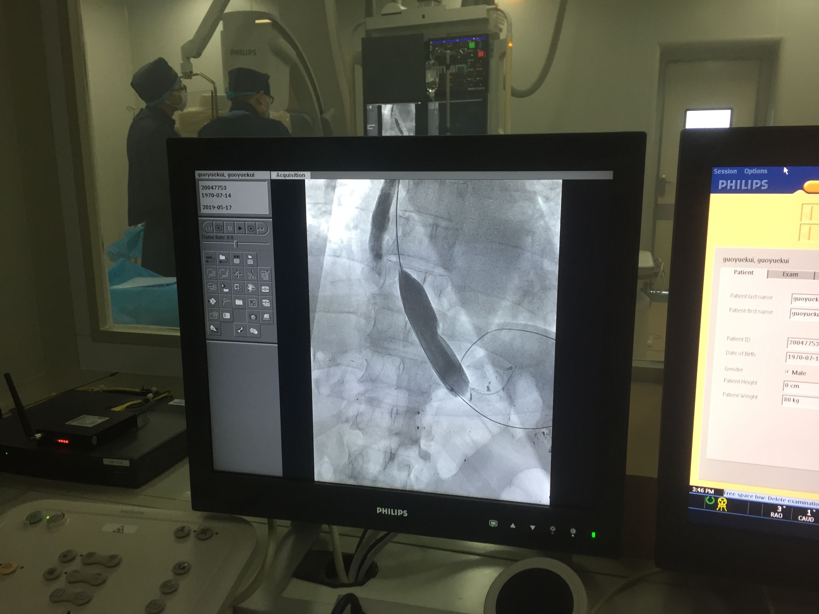 贲门失弛缓症不吃饭也噎得慌,酸导致的胸口痛是贲门没关上吗