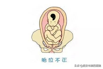 剖宫产的孩子和顺产的孩子的区别,一胎剖宫产二胎顺产的几率有多大