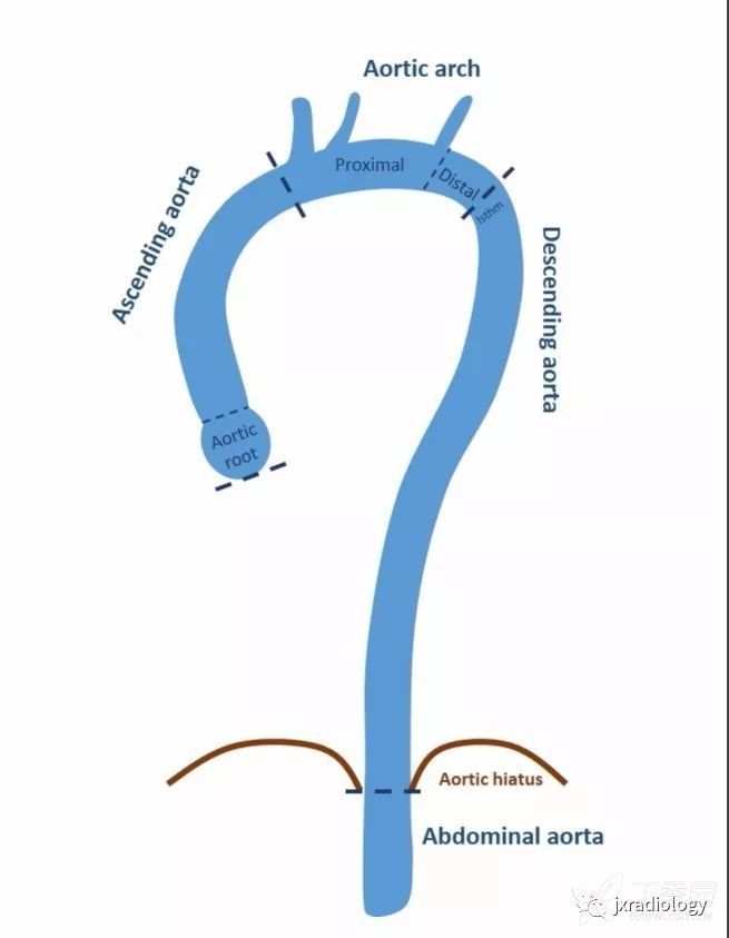 急性主动脉综合征报道,急性主动脉综合征症状