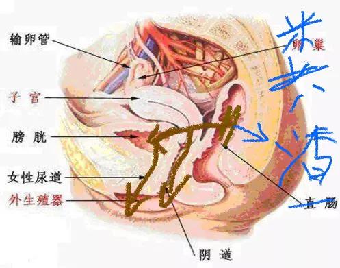 当女人膀胱、宫颈、直肠被癌症强行“打通”以后会是什么后果？