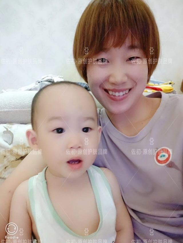 生完孩子烂脸,生完孩子脸上垮了怎样处理