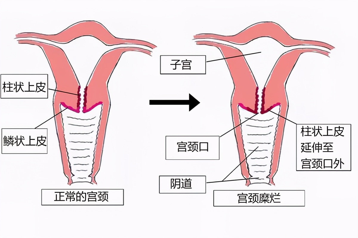 被医生忽悠的九种病,医生常常忽悠你的6种病