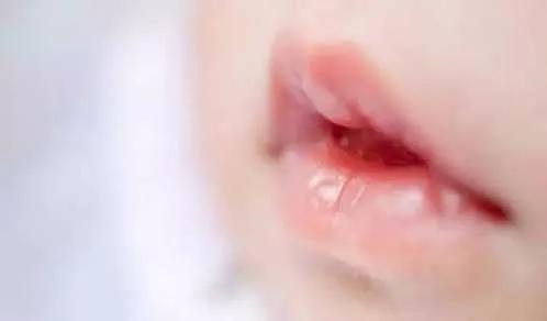 Lucar小课堂|春季干燥，做好孩子的唇部护理，简单！
