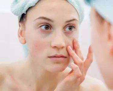 水肿型眼袋可以用维生素e去掉吗？