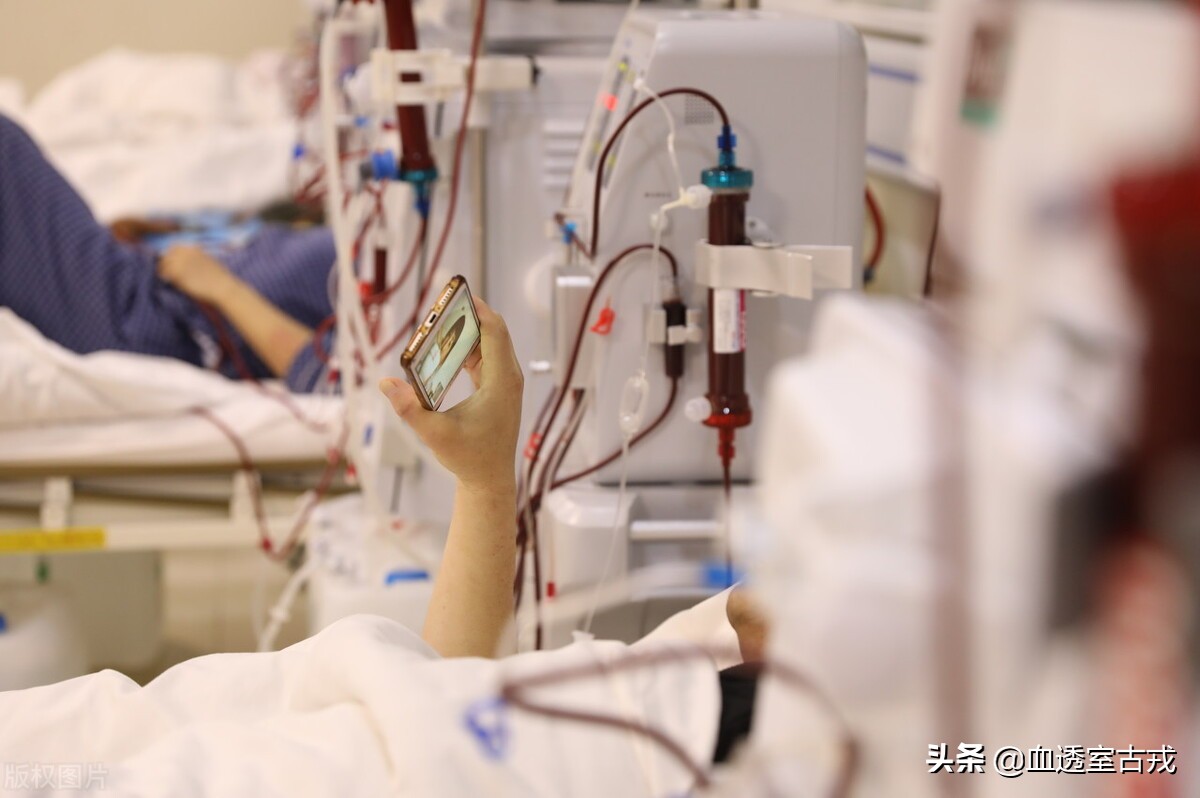 血液透析动静脉内瘘相关知识ppt,血液透析动静脉瘘