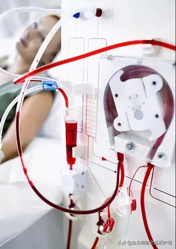 如何判断透析管路溶血,透析溶血率高的原因