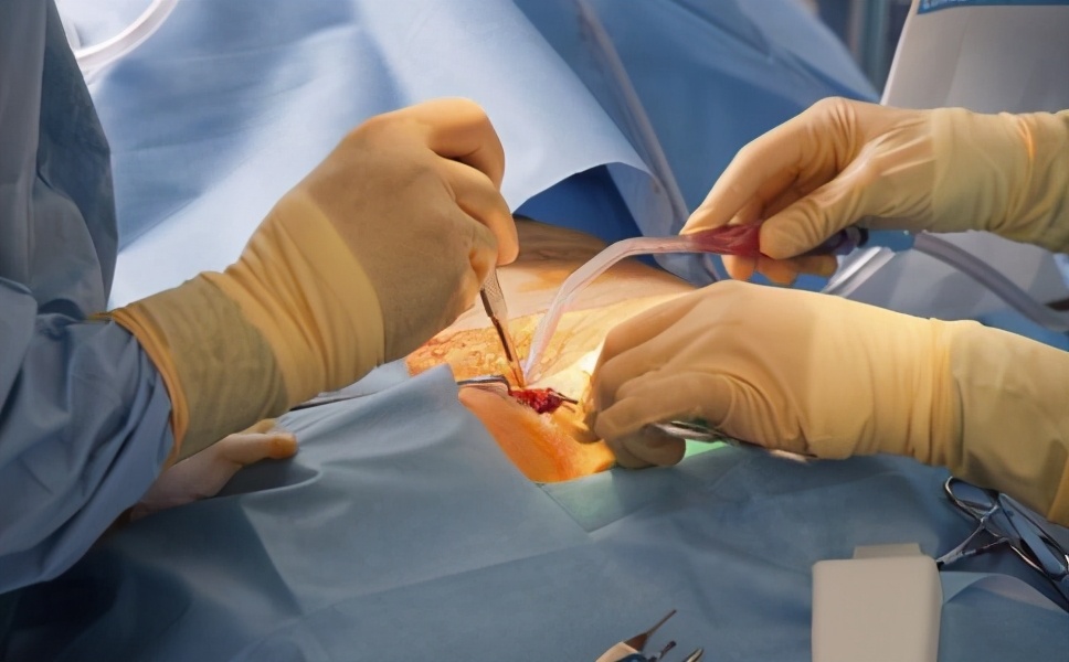 丁丁内摸到“硬块”、轻度弯曲，勃起疼痛加剧，要去看医生吗？