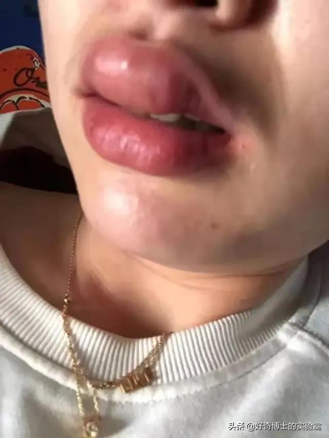 干掉蚊子的100种方法,消灭蚊子的100种方法第24种