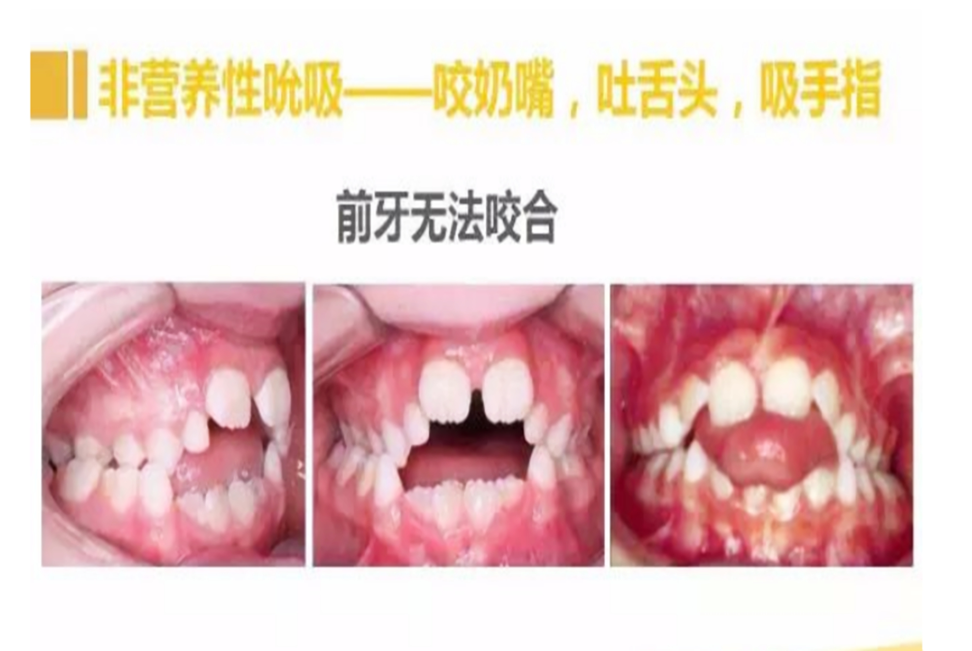 宝宝戒安抚奶嘴后容易哭闹,宝宝戒安抚奶嘴难不难