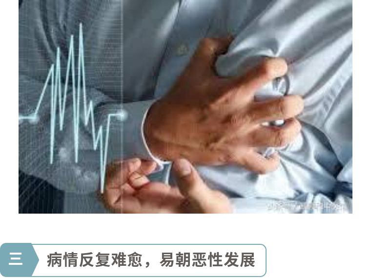 顽固静脉曲张千万别拖着,不痛不痒的静脉曲张可以不治吗
