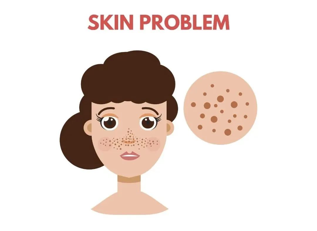 如何养成不长斑的皮肤,老了有什么办法不长斑