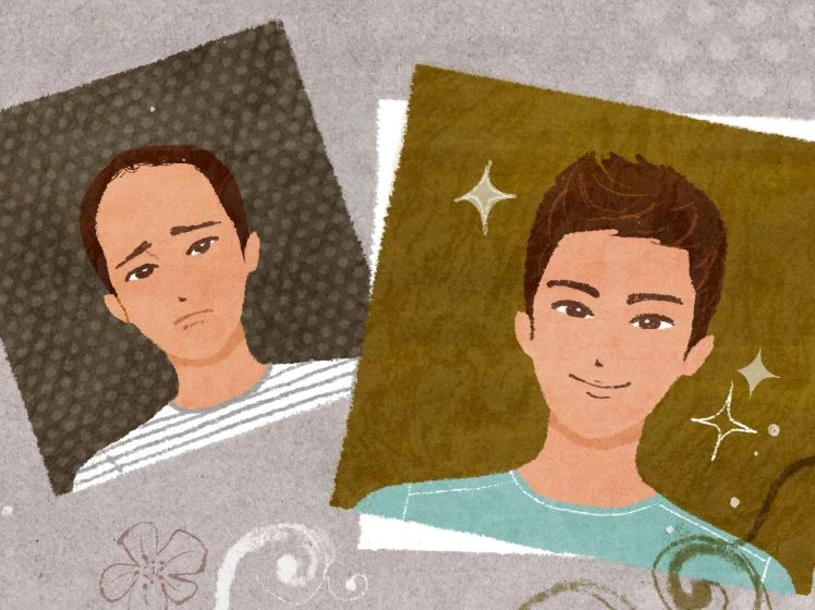 稳住你的发际线一招让你告别脱发,20岁大学生严重脱发怎么回事