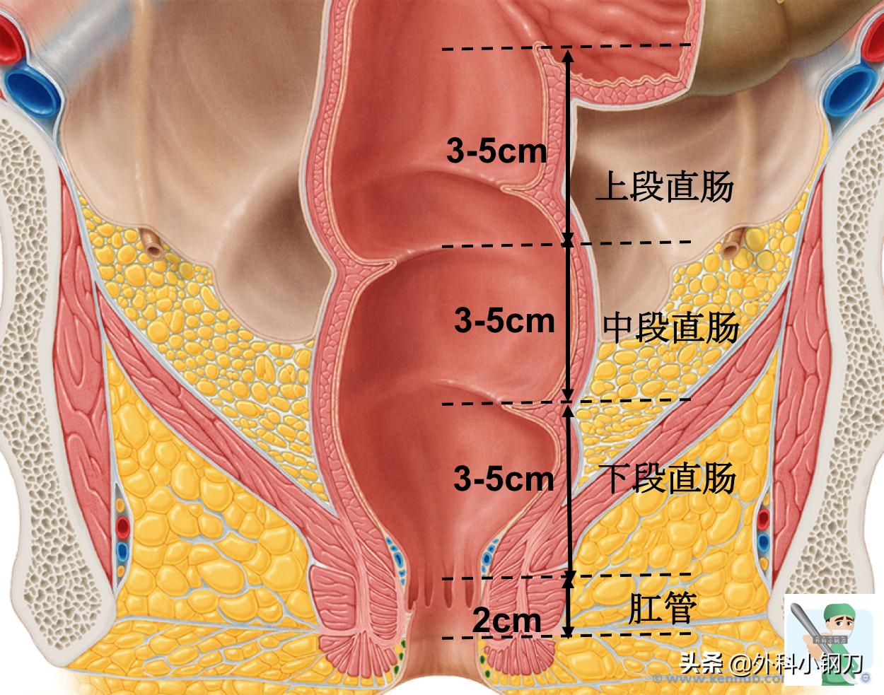 鍖荤敓鍓叉帀澶ц偁,鑲涢棬鍒囬櫎鍚庣画娌荤枟