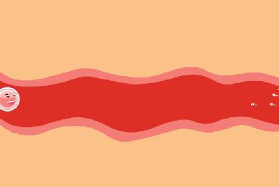 怎么才能确定是输卵管积水,输卵管积水避免加重