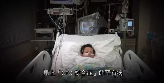 “幼儿看病4天花55万”上热搜，很多患了罕见病的孩子，无药可医