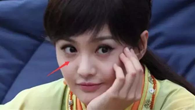 眼袋怎么消除简单方法男生,黑眼袋怎么消除最快方法男士